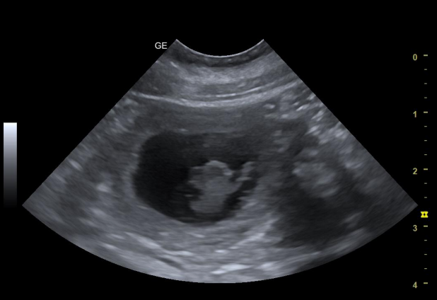 Ultraschallbild - Trächtigkeit bestätigt